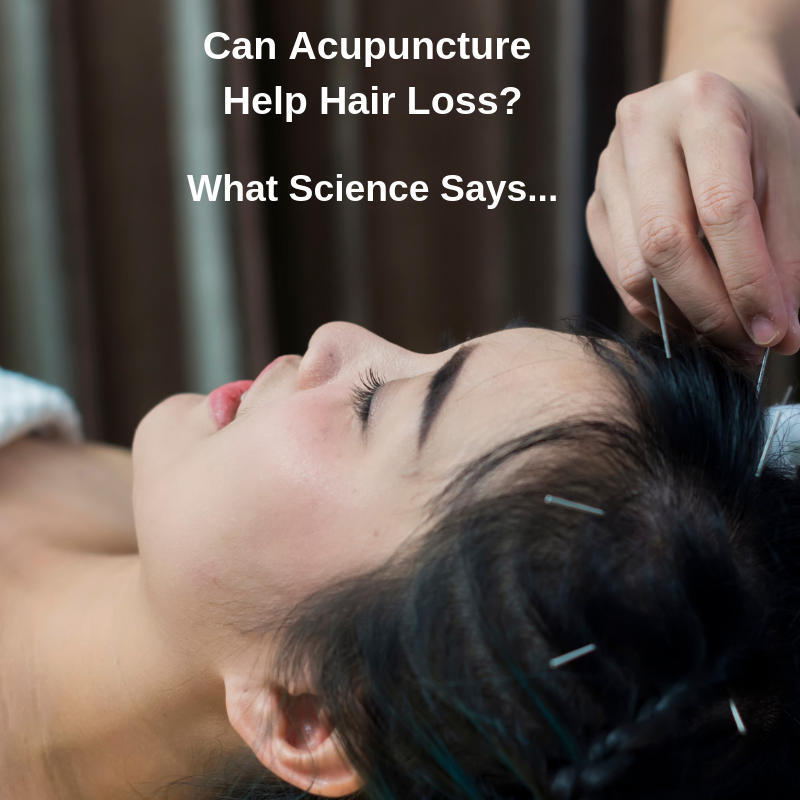 EES - Can Acupuncture Help Hair Loss?